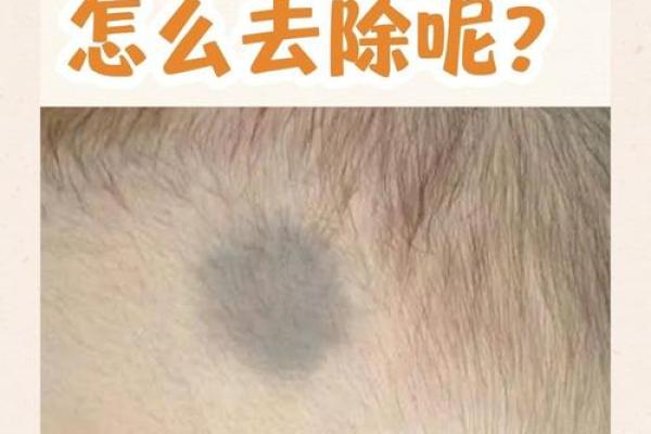 看胎记颜色类型算命