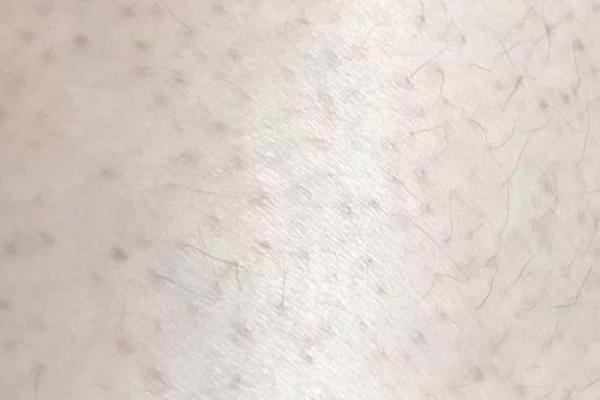 腿上有毛算命