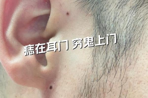 风水上耳朵有痣的人命运