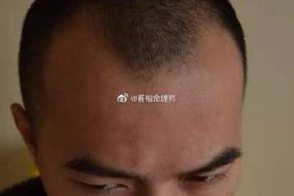 发际线的面相风水，你知道吗