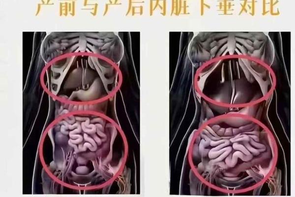 剖腹产与八字