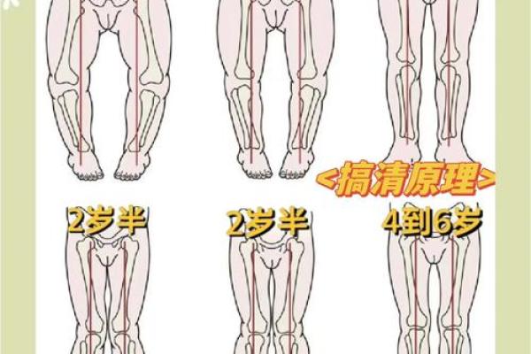 小孩走路内八字或者外八字有问题吗？该如何纠正？