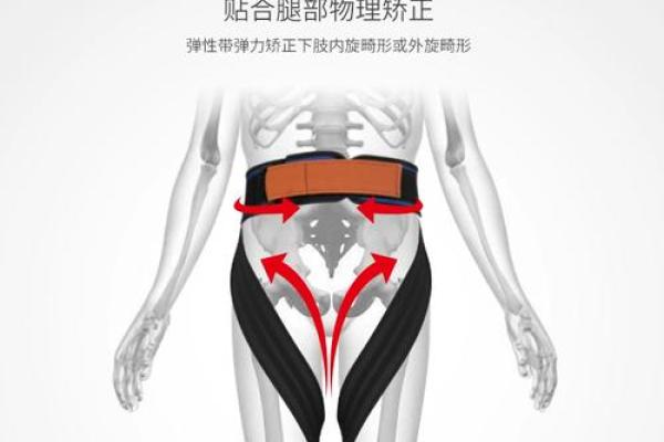 纠正外八字脚
