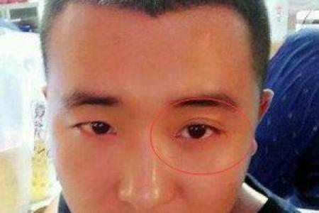 眼睛黑眼珠子多算命