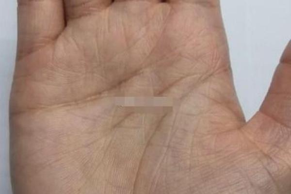 印堂八字纹的男人财运好吗