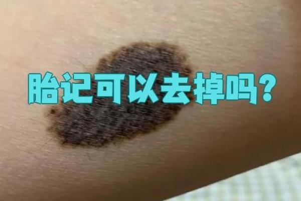 腿上不同位置的胎记算命
