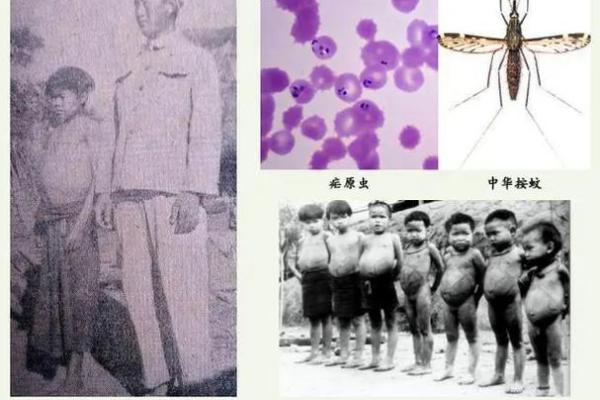 蚊子不喜欢什么血型 蚊子厌恶哪种血型